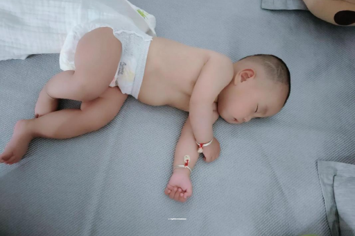 上海六个月宝宝眼睛散光